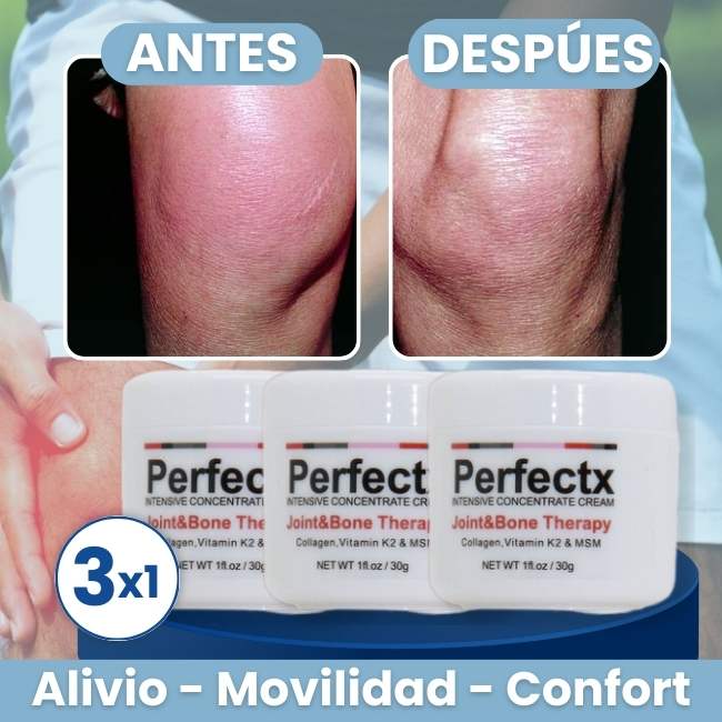 CREMA PERFECTX PARA ARTICULACIONES Y HUESOS